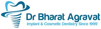 Dental Clinic in c339b2c9-e3d8-40d4-99a7-764faec263c9-Dr-Bharat-Agravat-Best-Cosmetic-Dentist-Dental-Implants-Clinic-in-Ahmedabad-India-Dr-Bharat-Agravat