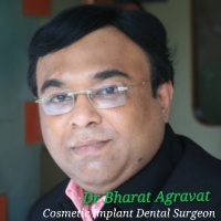 Dentist in c339b2c9-e3d8-40d4-99a7-764faec263c9-Dr-Bharat-Agravat-Best-Cosmetic-Dentist-Dental-Implants-Clinic-in-Ahmedabad-India-Dr-Bharat-Agravat