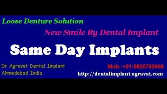 Dr Bharat Agravat Best Cosmetic Dentist Dental Implants Clinic in Ahmedabad India - Banner 1