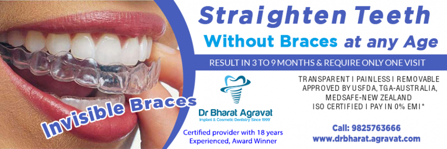 Dr Bharat Agravat Best Cosmetic Dentist Dental Implants Clinic in Ahmedabad India - Banner 2