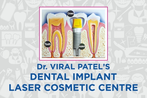 Dental Clinic in c61bd76d-9230-44be-abbe-bb03ba4d8fad-Dental-Implant-Laser-Cosmetic-Centre-Dr-Viral-Patel